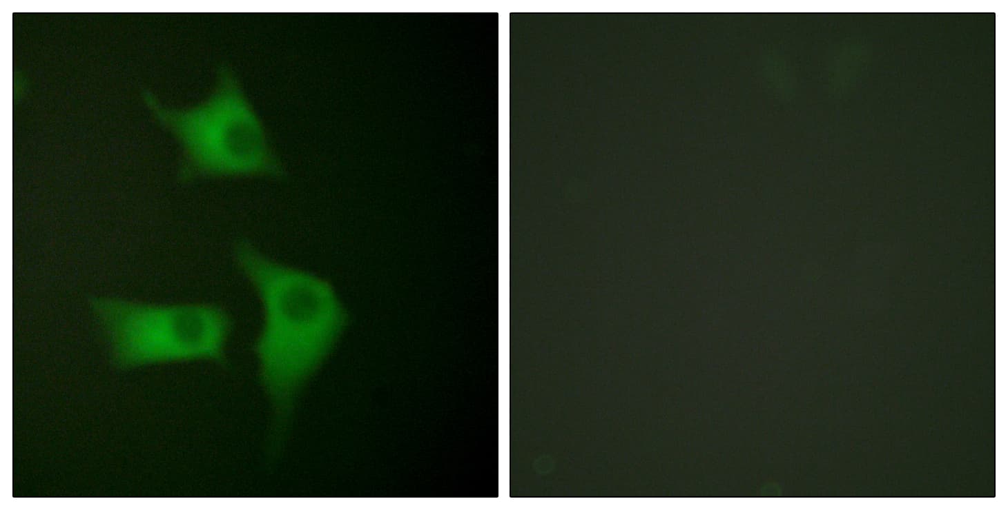 CDKN2B / p15 INK4b Antibody (aa89-138)