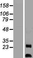AURKAIP1 / AKIP Protein (Over-Expression Lysate Myc-DDK (Flag))
