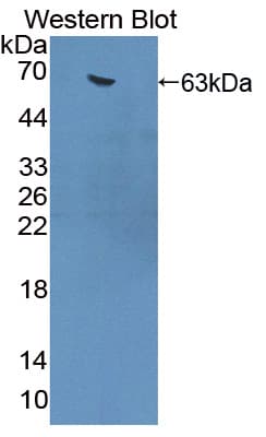 YARS / Tyrosyl-tRNA Synthetase Antibody (aa2-528)