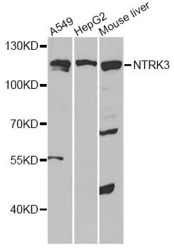 NTRK3 / TRKC Antibody