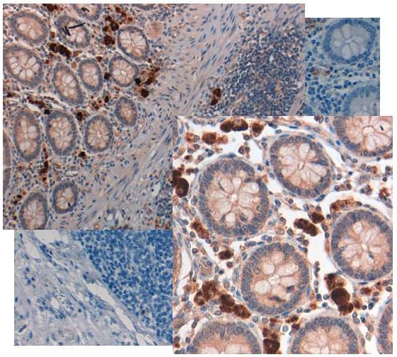 Polyclonal Rabbit anti-Human GDF15 Antibody (IHC, WB)