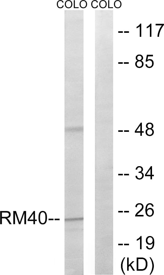MRPL40 Antibody (aa101-150)