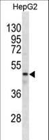 GABRR1 / GABA(A) Receptor rho- Antibody (aa19-48)