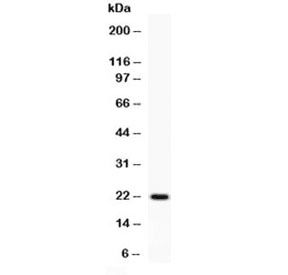 IFN Gamma / Interferon Gamma Antibody (aa23-156)