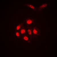 Polyclonal Rabbit anti-Human SAE1 Antibody (Internal, IHC, IF, WB)
