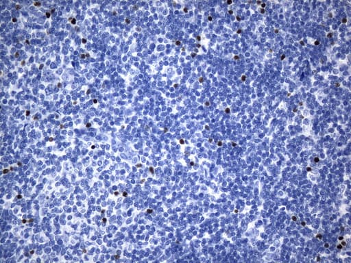FOXP3 Antibody (clone UMAB248)