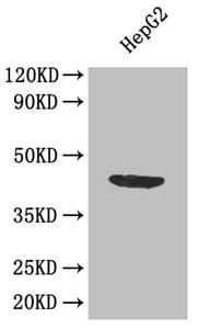 APOL1 / Apolipoprotein L Antibody (aa179-398)