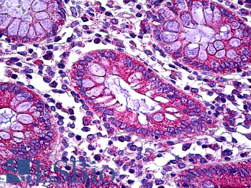 IHC-plus™ SLC6A6 / Taurine Transporter Antibody (aa561-610)