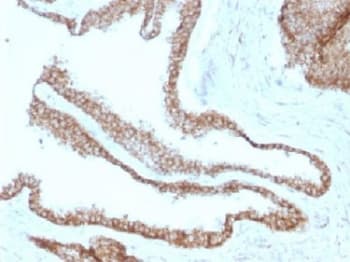 JUP/CTNNG/Junction Plakoglobin Antibody (clone CTNG/1664, Azide-free, BSA-free)