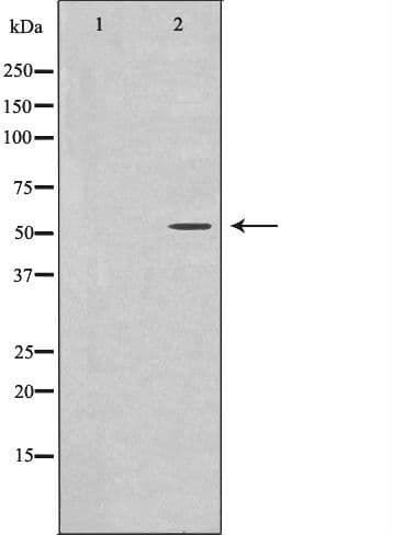 ATF7 Antibody