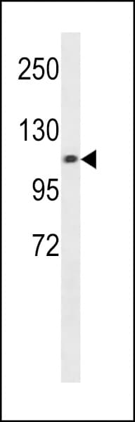 CHSY3 / CSS3 Antibody (aa531-560)