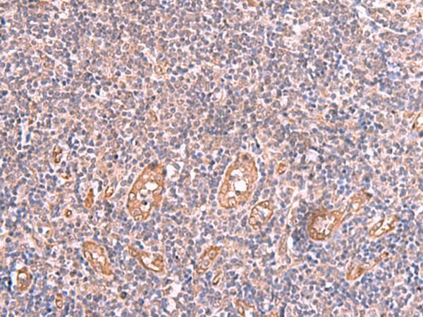 Polyclonal Rabbit anti-Human LMCD1 Antibody (IHC, WB)