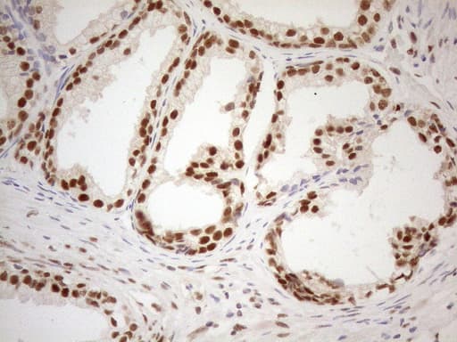 Monoclonal Mouse anti-Human RGL2 Antibody (clone OTI10F2, aa547-777, IHC, WB)