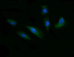 CD1C Antibody (clone OTI2F1)