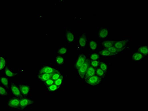 Polyclonal Rabbit anti-Human NUDT1 / MTH1 Antibody (IHC, IF)