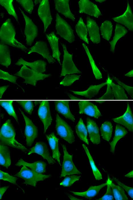 Polyclonal Rabbit anti-Human BRCA1 Antibody (IHC, IF, WB)