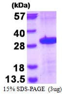 Human FCGR3A / CD16A Protein (Recombinant His)