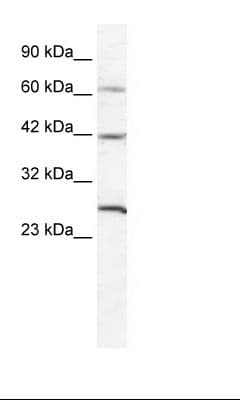 GJD3 / CX31.9 / Connexin 3.9 Antibody (aa31-80)