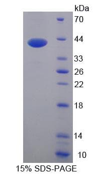 Human DEFA6 / Defensin 6 Protein (Recombinant His-GST-S)