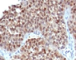 CDKN1A / WAF1 / p21 Antibody (clone WAF21-1)
