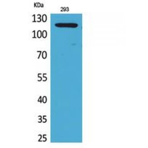 Polyclonal Rabbit anti-Human ATP2A2 / SERCA2 Antibody (841-890 aa, C-terminal, WB)