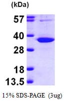 Human UP / UPP1 Protein (Recombinant His)
