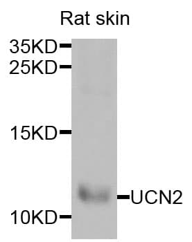 UCN2 / SRP Antibody
