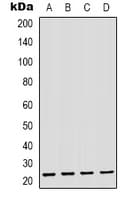 Polyclonal Rabbit anti-Human PMP22 Antibody (C-Terminus, IHC, WB)