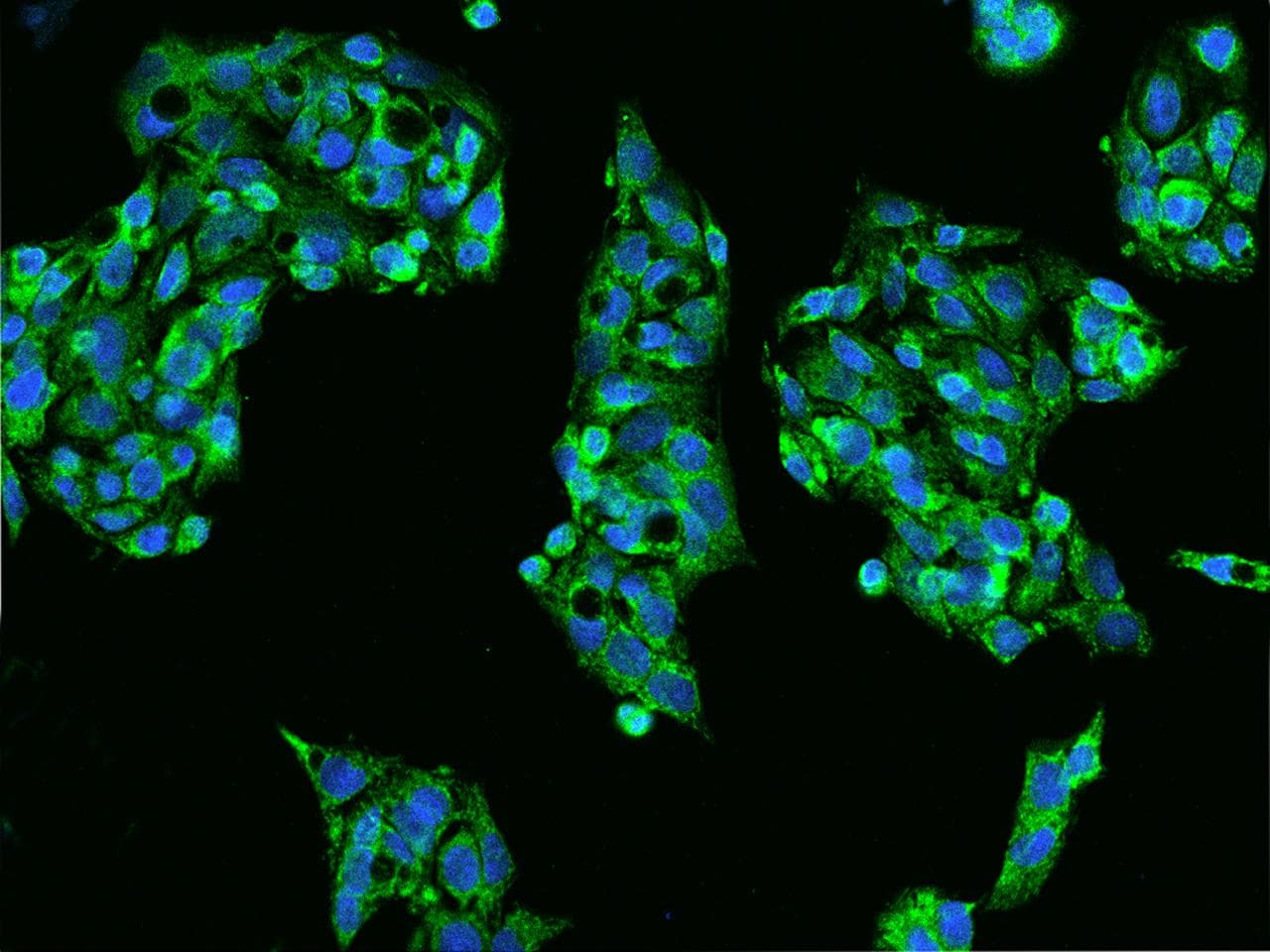 CD14 Antibody