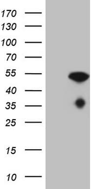 NUP43 Antibody (aa1-253, clone OTI7E5)