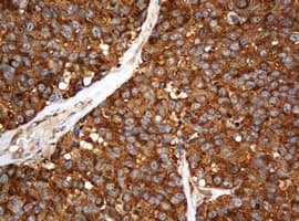 PAI-RBP1 / SERBP1 Antibody (aa1-262, clone OTI1E7)