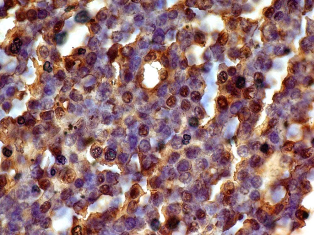 CCND1 / Cyclin D1 Antibody
