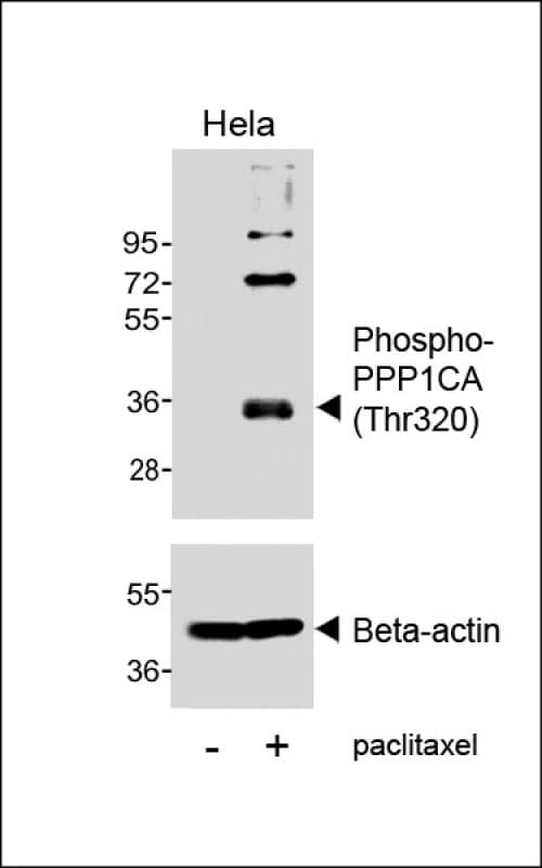 PPP1CA / PP1-Alpha Antibody (phospho-Thr320)