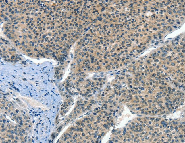 CRLF2 / TSLPR Antibody