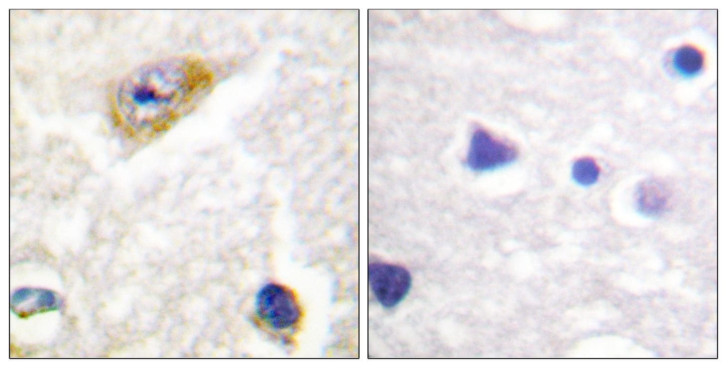 CaMKII Alpha+Beta+Delta Antibody (Ab-305)