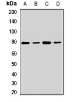Polyclonal Rabbit anti-Human GFPT1 / GFAT Antibody (IHC, WB)