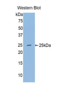 ACAN / Aggrecan Antibody (aa2163-2316)