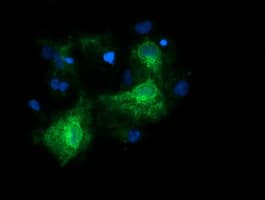 RARRES1 Antibody (clone OTI2E12)