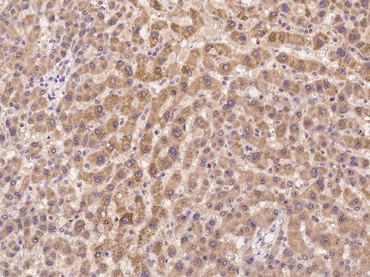 FURIN Antibody