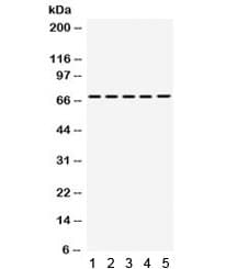 Polyclonal Rabbit anti-Human STXBP1 / MUNC18-1 Antibody (IHC, WB)