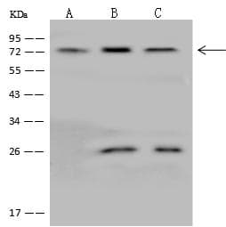 Polyclonal Rabbit anti-Human Spastic / GLRB Antibody (IHC, WB)