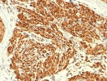 CNN1 / Calponin Antibody (clone CALP)