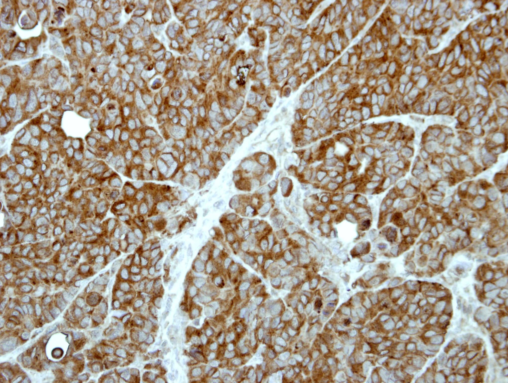 Polyclonal Rabbit anti-Human LAMTOR3 / MP1 Antibody (aa1-124, IHC, WB)