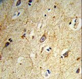 Polyclonal Rabbit anti-Human GABARAPL1 / ATG8 Antibody (IHC, WB)