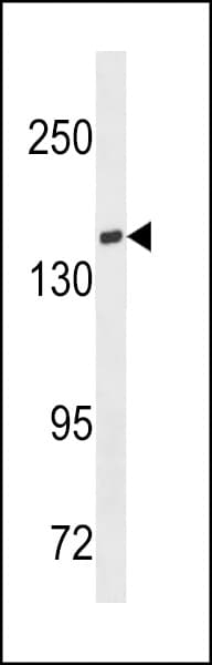 PathPlus™ Polyclonal Rabbit anti-Human TIAM1 Antibody (aa1478-1506, IHC, WB)