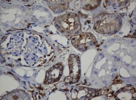CDH1 / E Cadherin Antibody (clone OTI1B11)