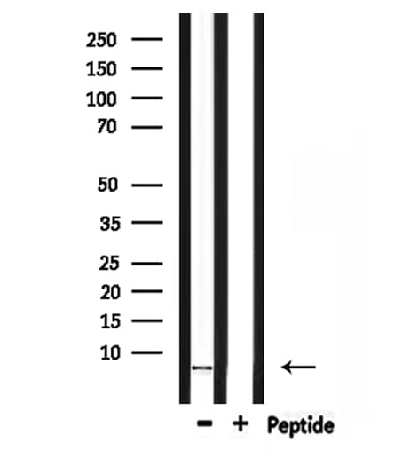 Polyclonal Rabbit anti-Human COX7C Antibody (IHC, WB)