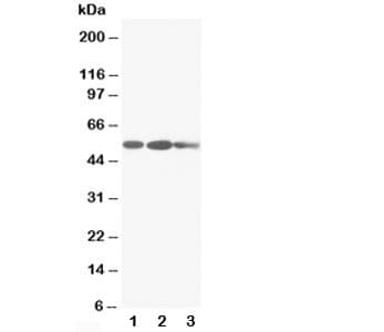 Polyclonal Rabbit anti-Human KRT8 / CK8 / Cytokeratin 8 Antibody (aa127-145, IHC, WB)