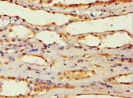 Polyclonal Rabbit anti-Human AFAP1 / AFAP Antibody (aa461-730, IHC)