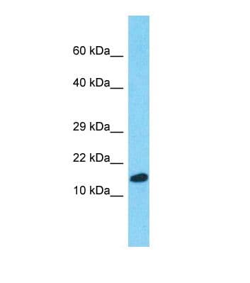 PPIA / Cyclophilin A Antibody (aa71-120)